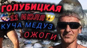 😱ГОЛУБИЦКАЯ😱МЕДУЗЫ,ОЖОГИ ОТ МЕДУЗ😱ЛЮДИ В ШОКЕ!!!ВЫЗЫВАЕМ ВРАЧА😱11 ИЮЛЯ #голубицкая #азовскоеморе
