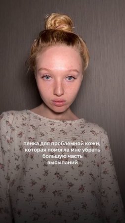 уход за кожей