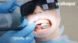Профессиональная гигиена полости рта в САКАРА