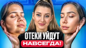 ОТЁКИ УЙДУТ УЖЕ ЗАВТРА! ПРОСТЫЕ ПРАВИЛА КАК РАЗГОНАТЬ ЛИМФУ
