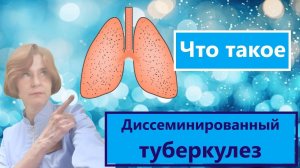 Диссеминированный туберкулез