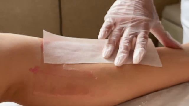 Вросшие волосы на ногах после депиляции - в этом виноват клиент смотреть онлайн