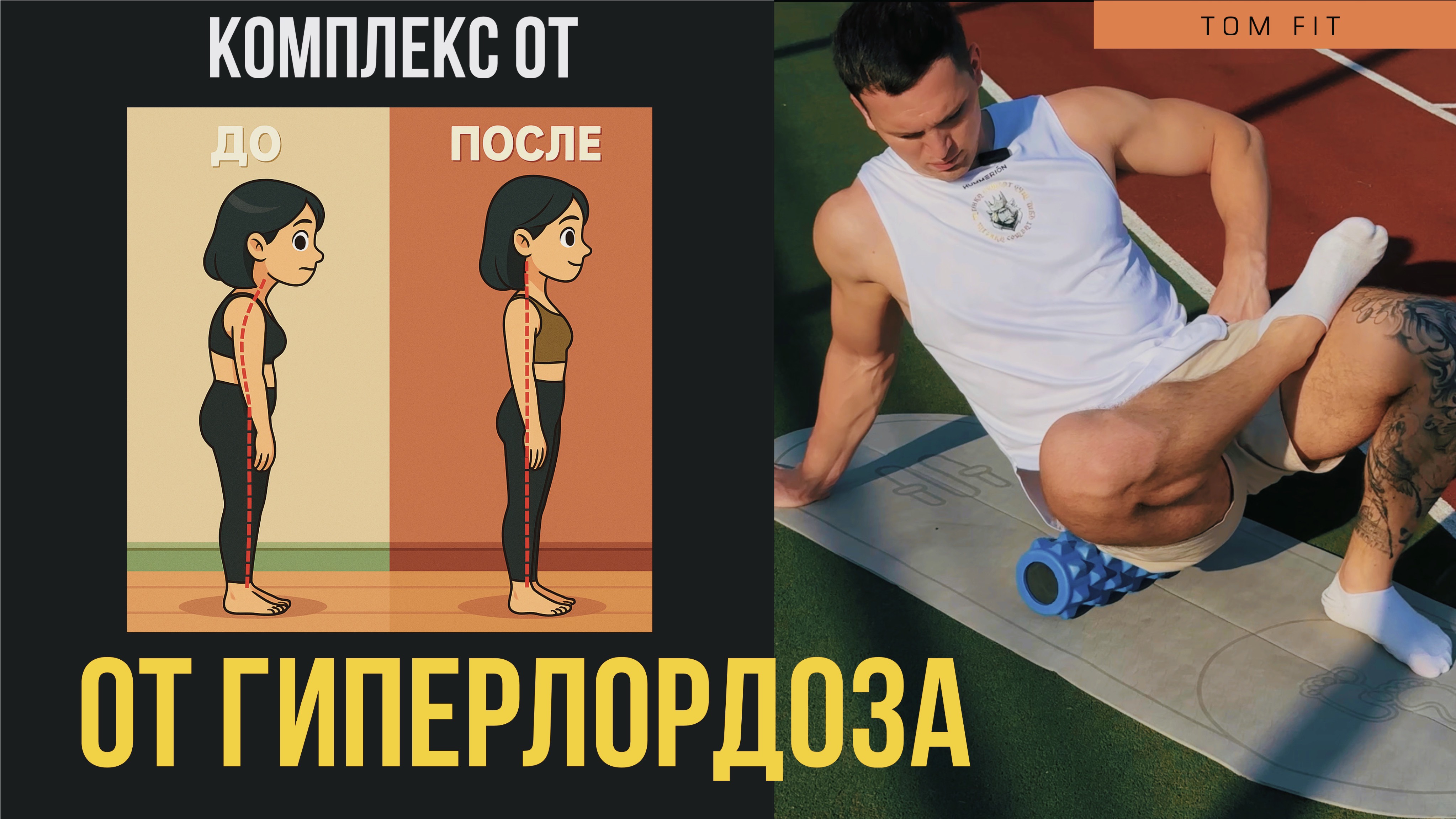 Как ИЗБАВИТЬСЯ от ГИПЕРЛОРДОЗА? Комплесный подход