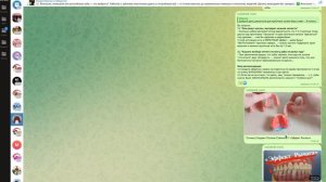 Доверяй, но ПРОВЕРЯЙ... #безнёбасъёмныепротезы #зубныепротезы #съёмныепротезы #протезирование