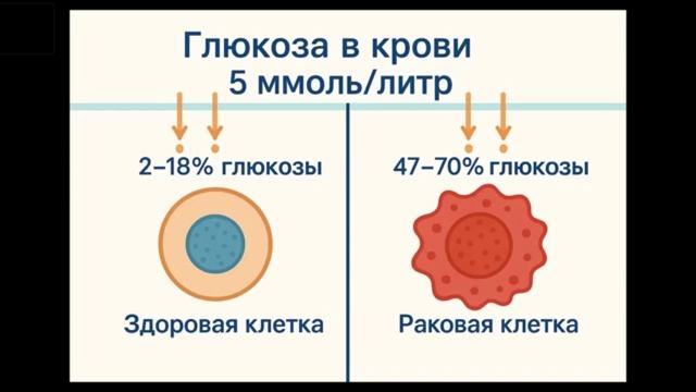 Рак - ловушка для глюкозы. Как влияет отказ от сладкого на рак.