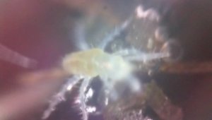 Паразит под микроскопом. Удивительная природа.