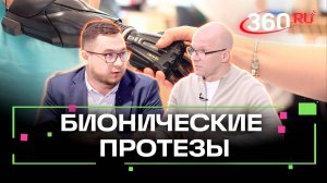 Бионические протезы: на что они способны