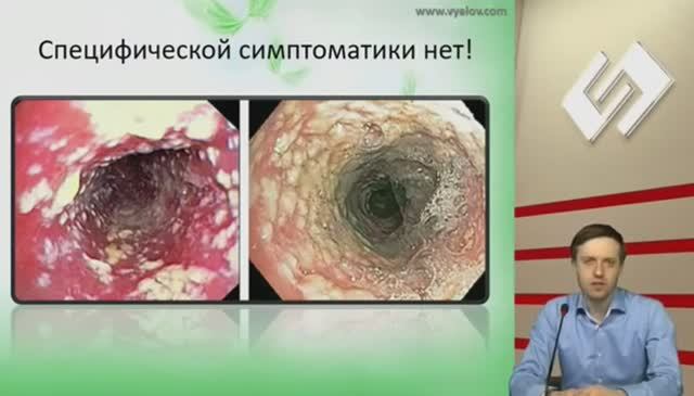 Паразитарные инвазии. Грибковые инфекции