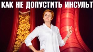 Лучшая еда для очищения и укрепления сосудов! Вредные и полезные продукты для здоровья сосудов.