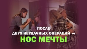 Из греческого носа в изящный: вторичная ринопластика у Репиной Аси Сергеевны