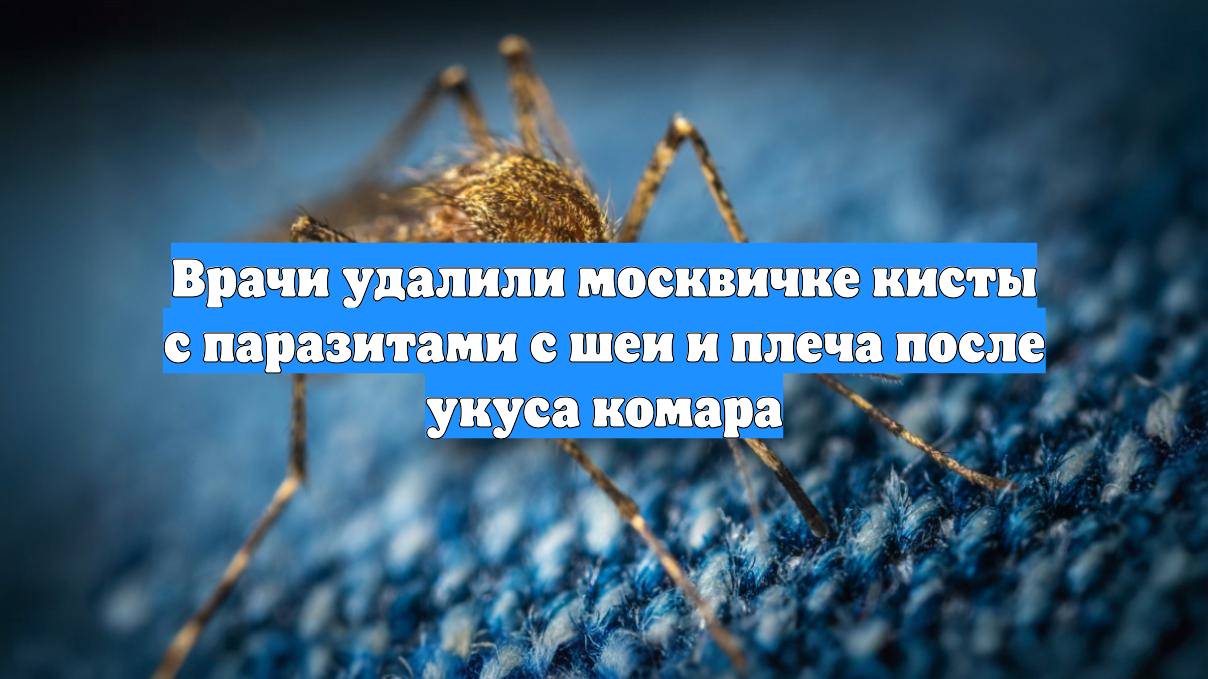 Врачи удалили москвичке кисты с паразитами с шеи и плеча после укуса комара