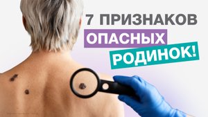 Как ВОВРЕМЯ заметить ОПАСНУЮ РОДИНКУ?