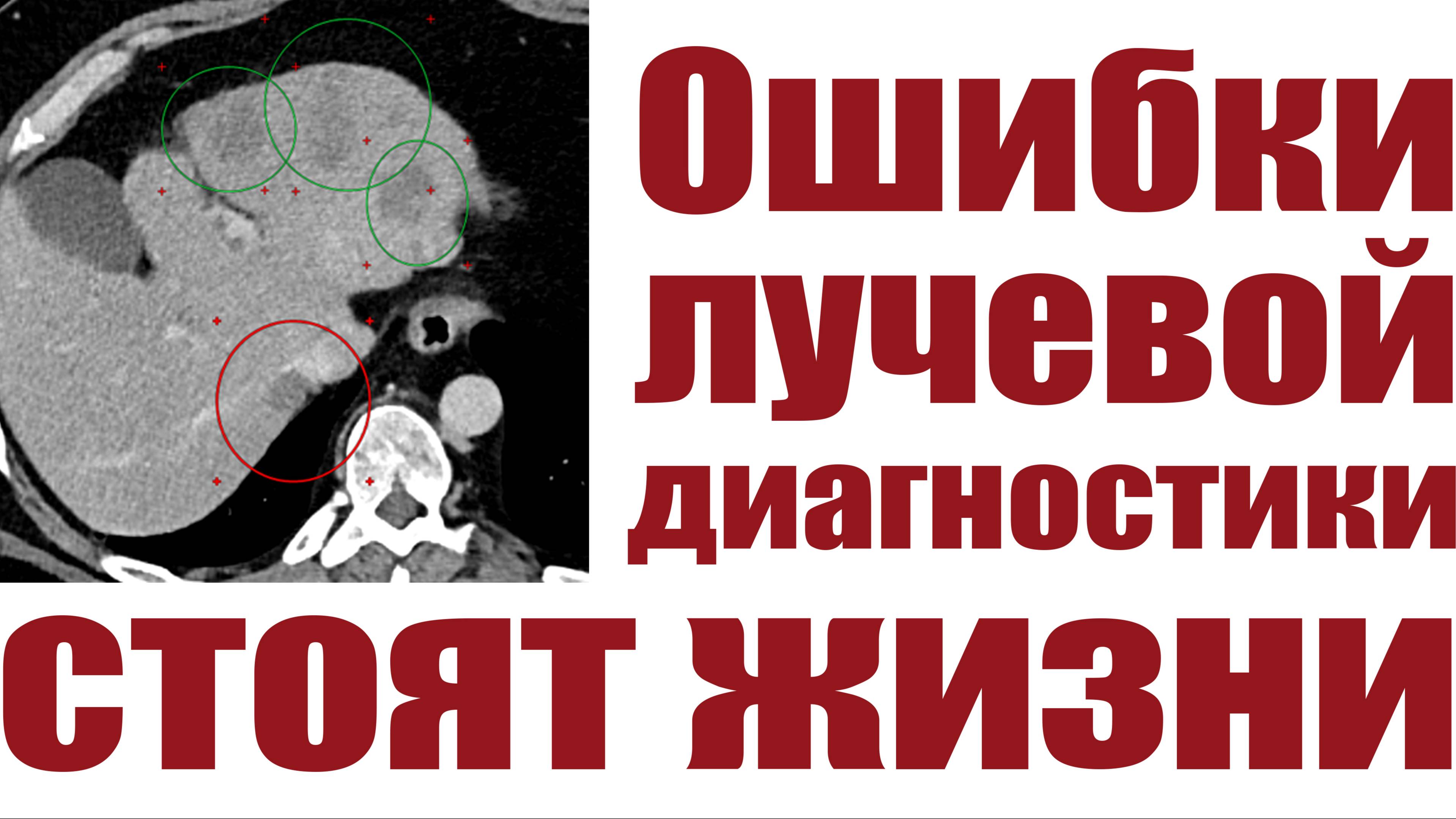 Ошибки лучевой диагностики стоят жизни