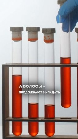 Как остановить волосопад и облысение? Смотрите в полном выпуске на канале Табу