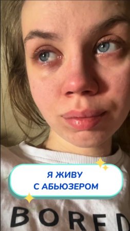 Я живу с АБЬЮЗЕРОМ 🚩🚩Артикул на WB #234577722💫Ozon #1664064287