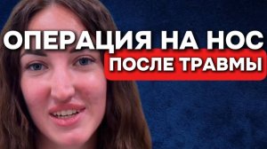 Нос не дышал 5 лет — ринопластика изменила мою жизнь | Отзыв пациентки
