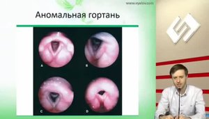 ВНЕ симптомы: внепищеводные, внепеченочные, внекишечные