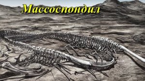 Массоспондил