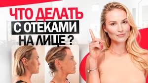 Отеки на лице? Всё, что ты должна знать и как от них избавиться!