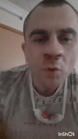 Здоровье.Операция на верхнечельстной пазухе.Фильм3.Серия4.Часть1.mp4