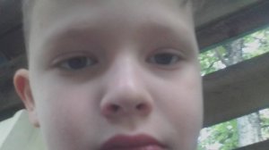 Я упал  с велосипеда