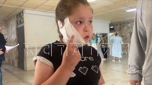 Бойцовская собака при своей хозяйке напала и изуродовала 9-летнюю девочку