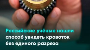 Российские учёные нашли способ увидеть кровоток без единого разреза
