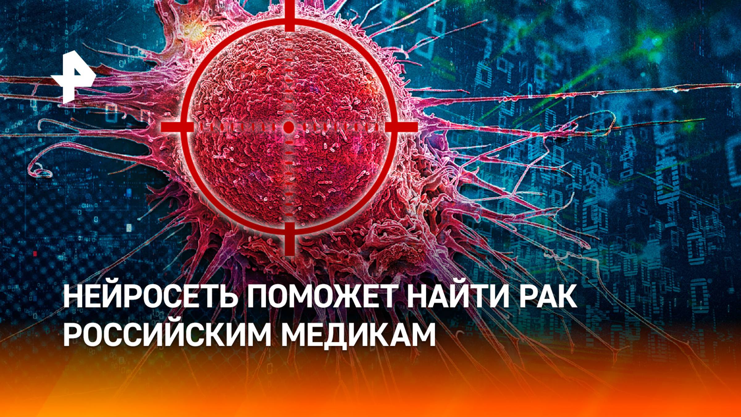 В институте Сеченова научили нейросеть находить раковые опухоли