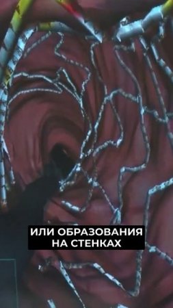 📍Врачи региона освоили самую точную в мире диагностику сосудов