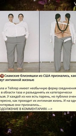 ������������Сиамские близняшки из США признались, как живут интимной жизнью_I