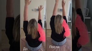 Плечелопатночный периартрит за 3 минуты.mp4