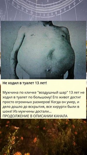 1_Не ходил в туалет 13 лет!_W