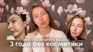 3 года без косметики: мой опыт. Как принять себя даже с акне?