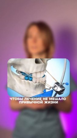 «Почему моему ребенку назначили лицевую ортодонтическую маску?» 🥺