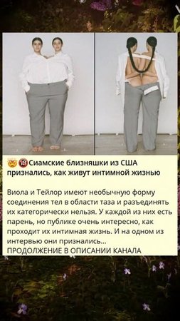 8_--Сиамские близняшки из США признались, как живут интимной жизнью_8