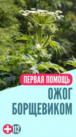 Ожог борщевика #перваяпомощь #перваяпомощьдетям