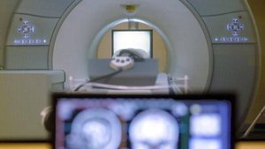 В США мужчину затянуло в аппарат МРТ из-за цепочки на шее