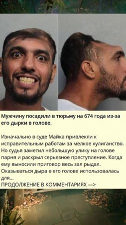 b_377_Мужчину посадили в тюрьму на 674 года из-за его дырки в голове._P
