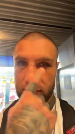 Alex Terrible Talks Post-Fight Damage… It’s Serious