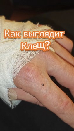 Как выглядит клещ