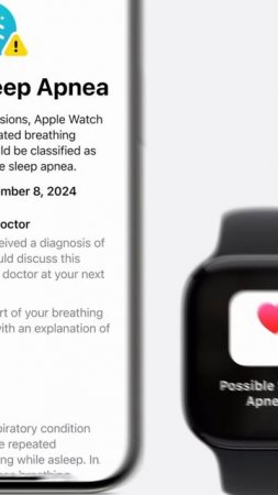 Слухи об Apple Watch 11-й серии 👀