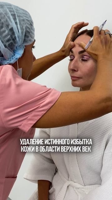 Как часто делать БЛЕФАРОПЛАСТИКУ?! красота здоровье медицина пластика хирург врач