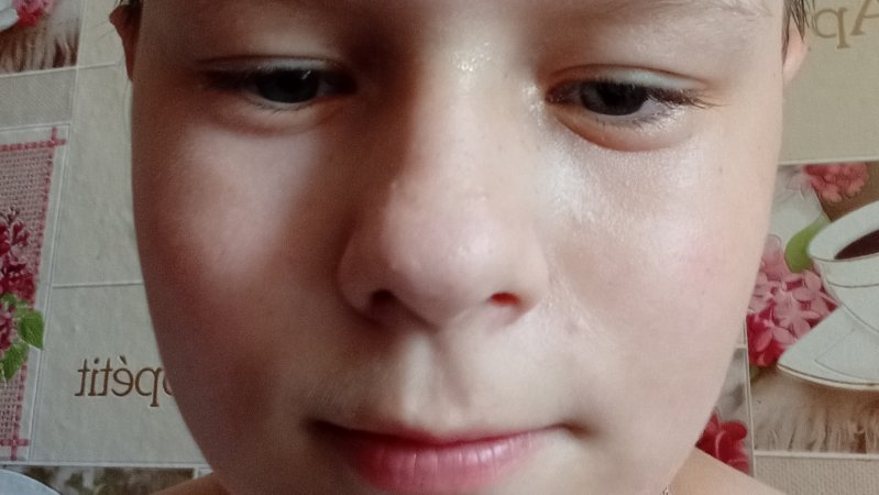 22-07-2025