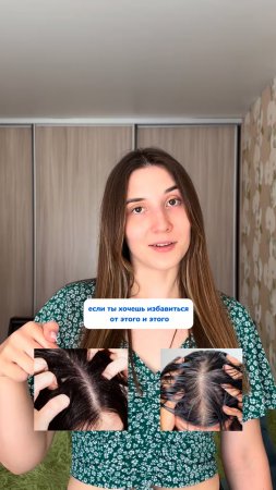 Как избавиться от зуда и перхоти