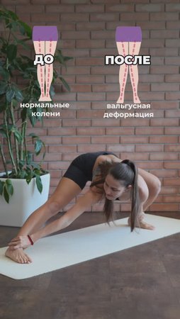 Упражнения от деформации. Подпишись и читай описание ✅