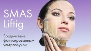 Ультразвуковой SMAS-лифтинг за одну процедуру