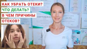 КАК УБРАТЬ ОТЕКИ? Как похудеть и снять отеки? Как вывести воду из организма? Причины отеков.