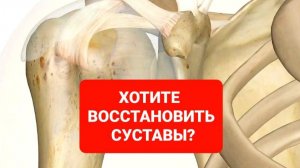 КАК ВОССТАНОВИТЬ СУСТАВЫ?