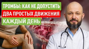 Тромбы: как не допустить. Два простых движения — каждый день