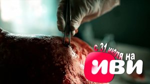 ≪Хирург≫: премьера 1 сезона - 31 июля 2025 г. на "Иви" (трейлер)